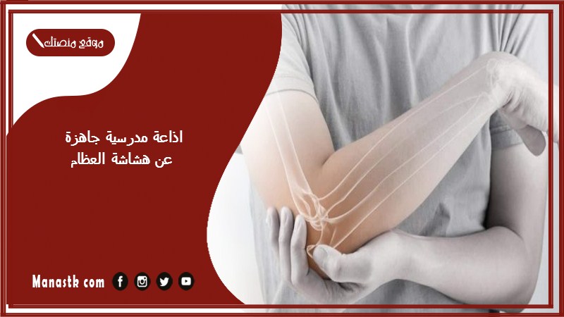 اذاعة مدرسية جاهزة عن هشاشة العظام