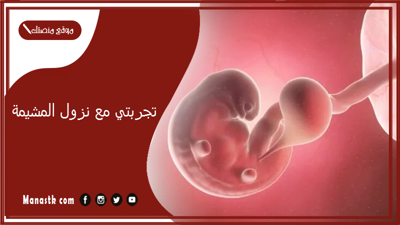 تجربتي مع نزول المشيمة